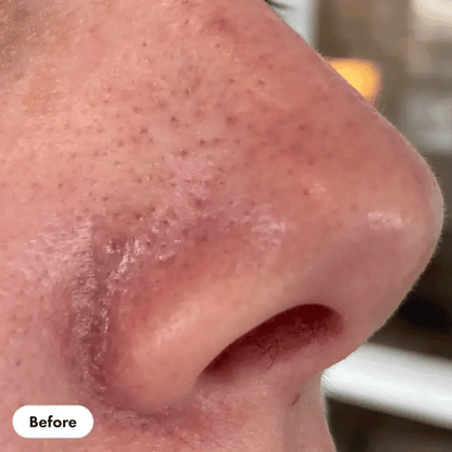 Green Mask - Elimina Impurezas Del Rostro - Compra 2 Y Lleva 1 Gratis